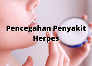 pencegahan penyakit herpes