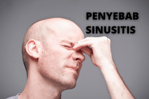 penyebab sinusitis