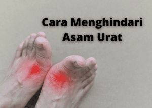 cara menghidari sama urat